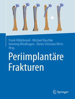 hildebrand_periimplantaere_frakturem