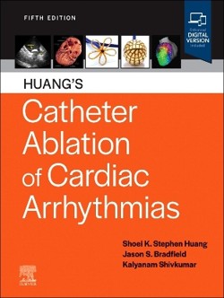 huang_catheter_ablation_5a