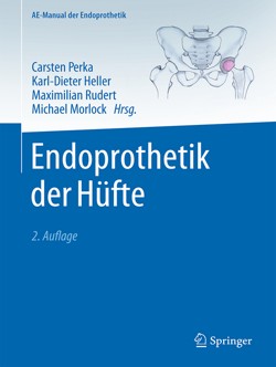 perka_endoprothetik_huefte_2a