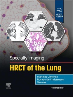 rosado_speciality_imaging_hr-ct_3a